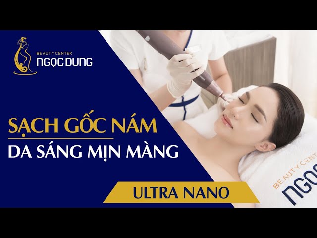 Điều Trị Nám Da Bằng Công Nghệ Laser Ultra Nano | NÁM DA |