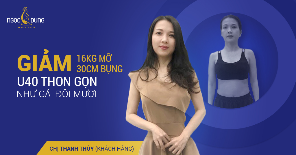 Giảm ngay 13Kg và 30 Cm vùng bụng U40 lấy lại vóc dáng vạn người mê