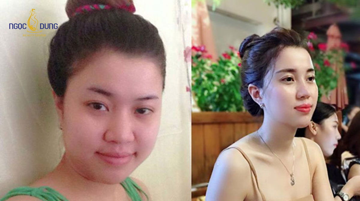 Hoàng Thùy, Giang Ơi và hội chị em “lột xác” hoàn hảo, giơ cao slogan: Đẹp là phải hành động!