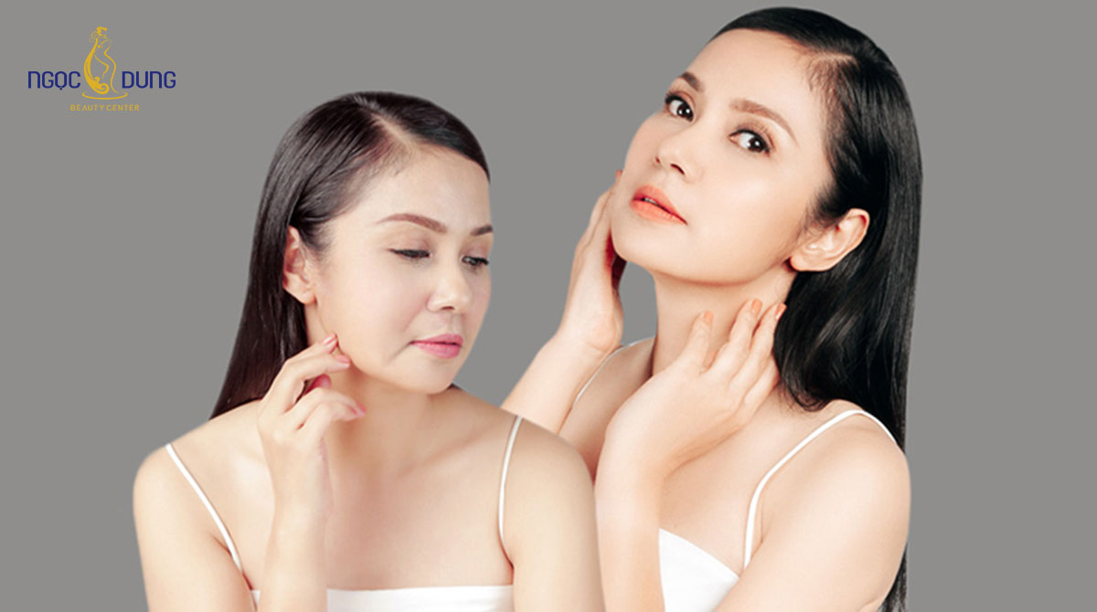 Việt Trinh đầu tư đến Thẩm mỹ viện làm đẹp, đây là gói dịch vụ phái đẹp nên cập nhật