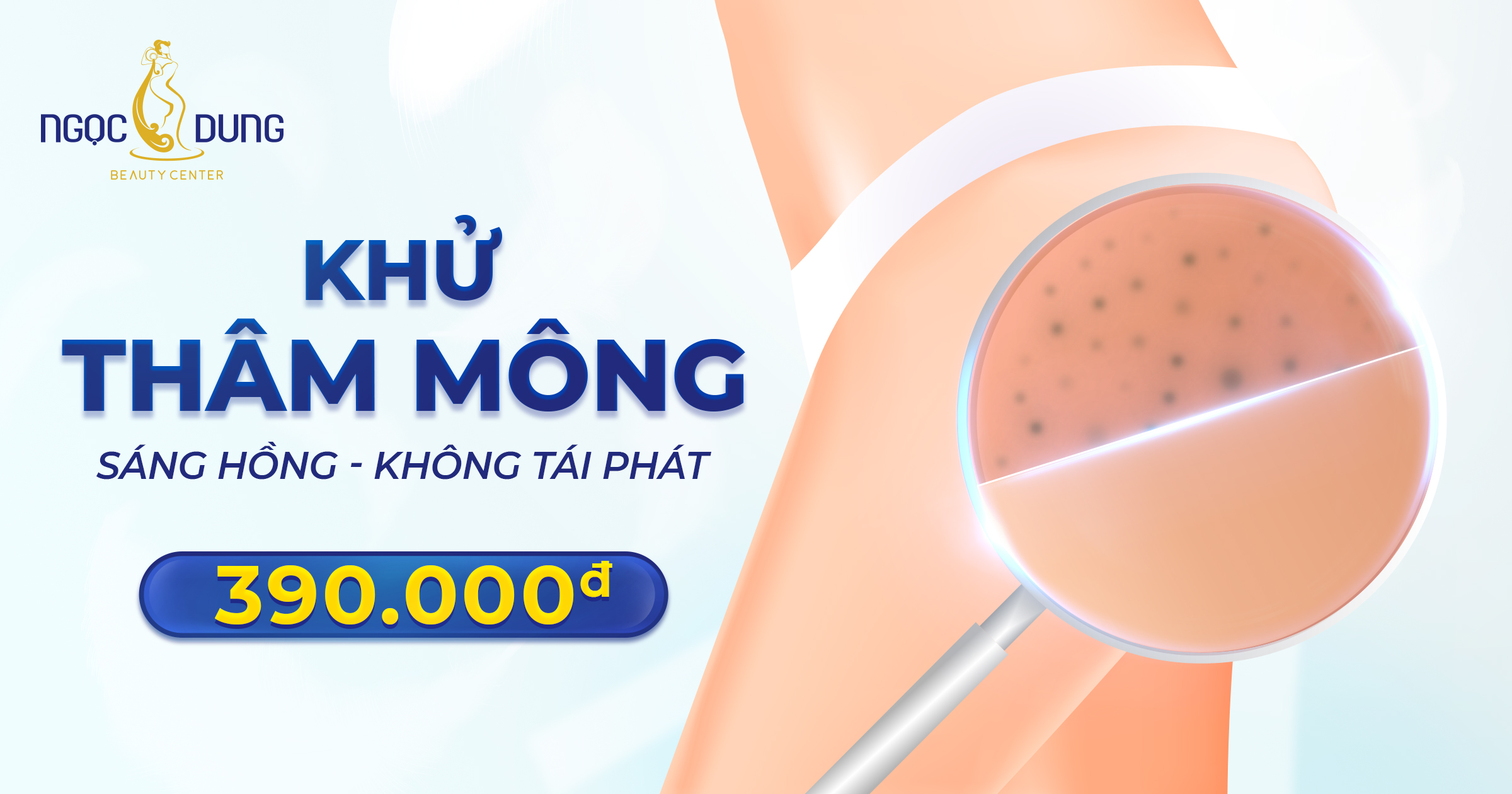 XÓA SẠCH THÂM MÔNG – TỰ TIN QUYẾN RŨ