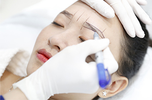 Phẩy sợi siêu thực