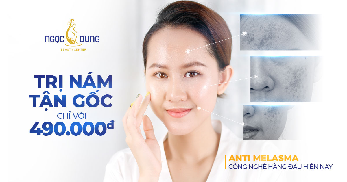 ANTI MELASMA GIẢI PHÁP MỚI XÓA BAY THÂM NÁM