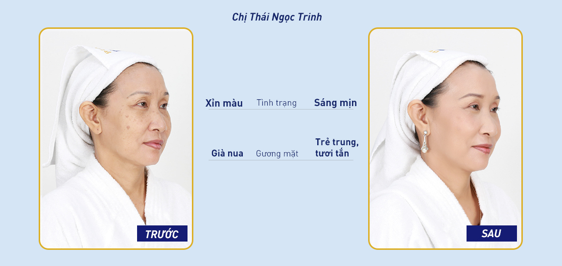 Ngọc Dung spa ở Biên Hòa