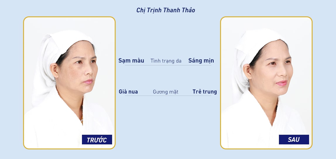 thẩm mỹ ngọc dung nha trang