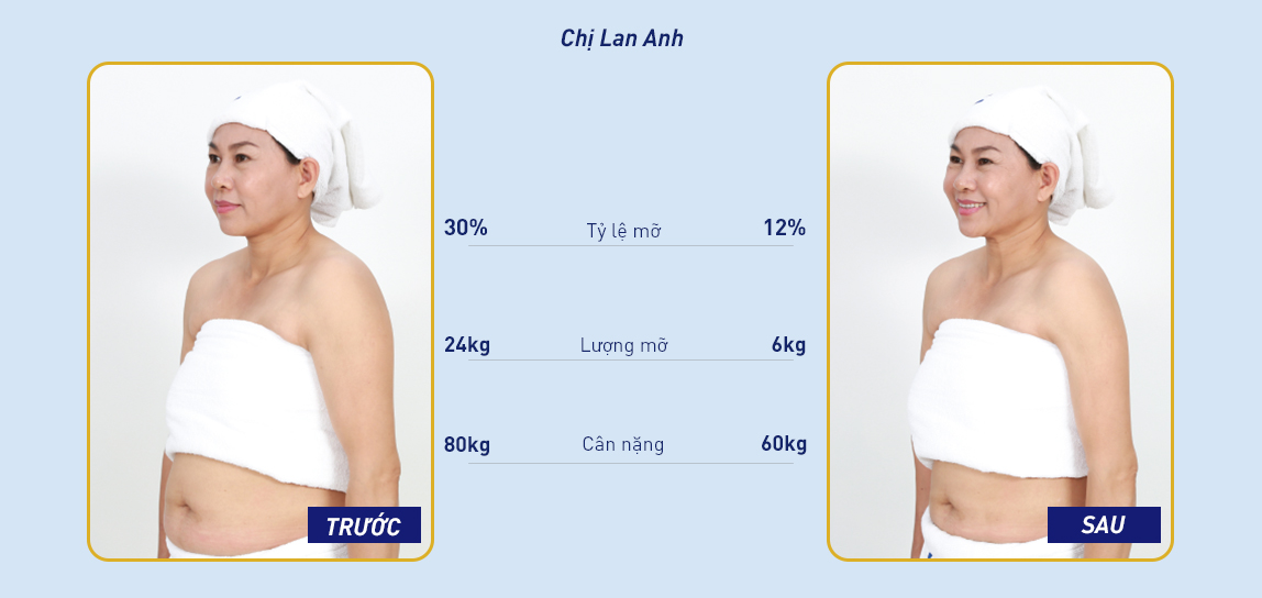 thẩm mỹ viện Ngọc Dung tại Biên Hòa