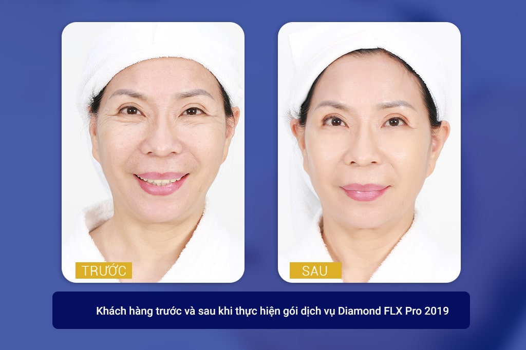 thẩm mỹ viện ngọc dung nha trang khánh hòa