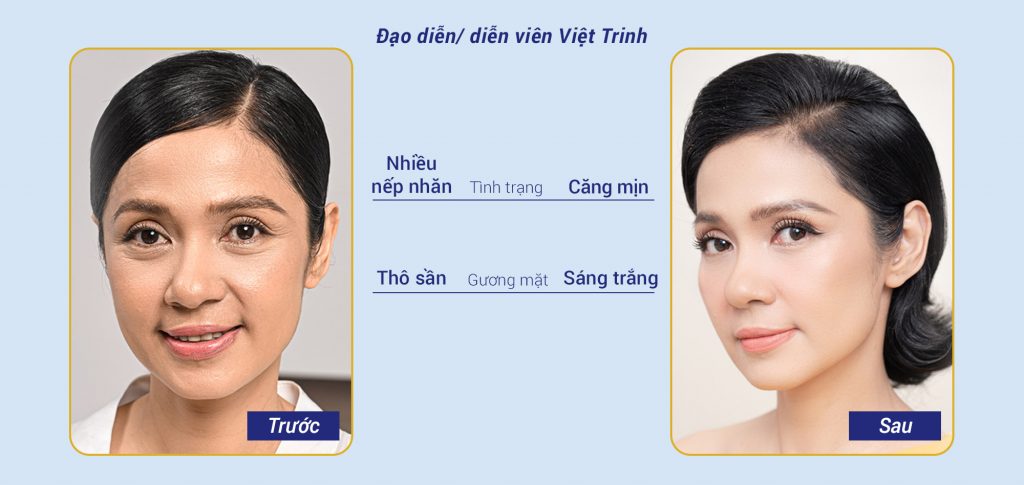 Trẻ hóa da là dịch vụ luôn được chị em yêu thích