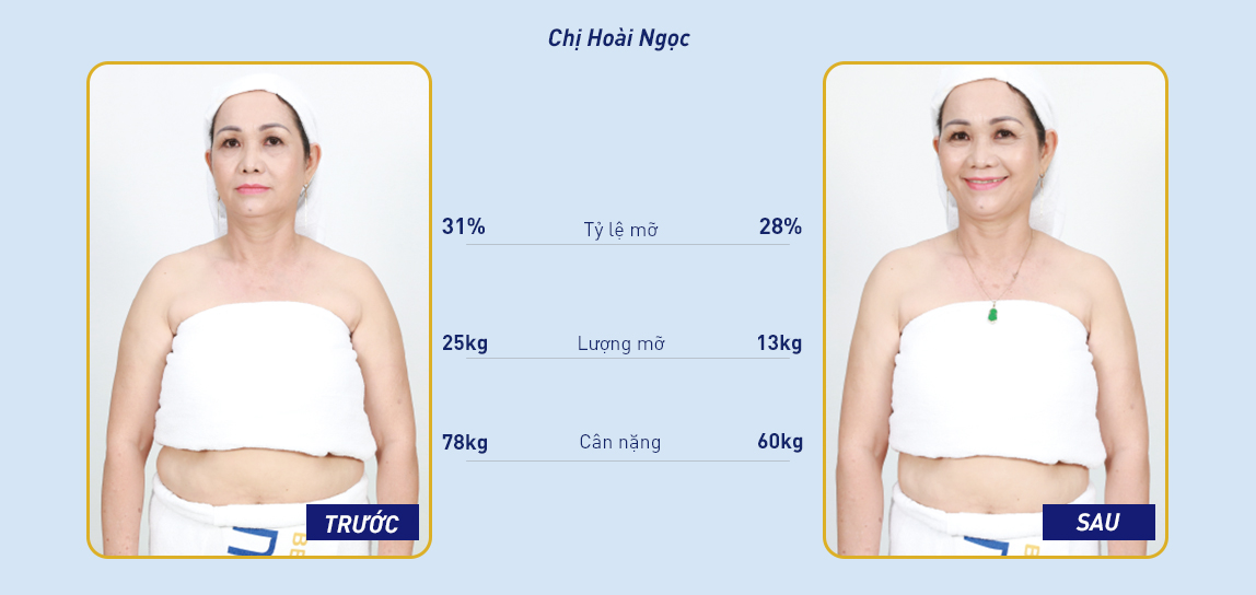 Dịch vụ giảm mỡ giúp chị em tự tin hơn