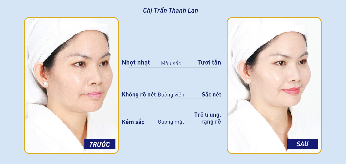 Charm môi Baby cho màu sắc tự nhiên, trẻ trung