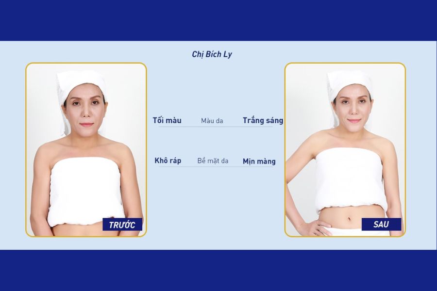 Dịch vụ tắm trắng tại Thẩm mỹ viện Cần Thơ - Ngọc Dung