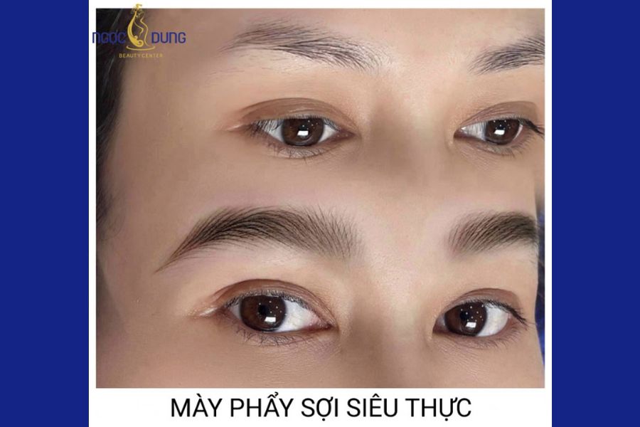 thẩm mỹ viện cần thơ