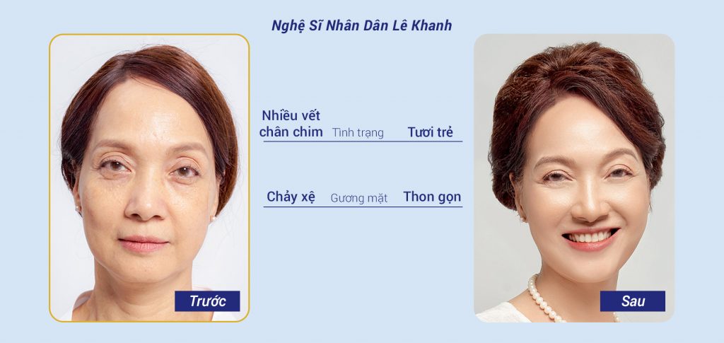 tmv ngọc dung nha trang