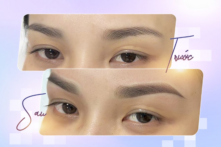 Hơn 10.000 khách hàng đã đăng ký dịch vụ Phun mày chạm hạt vi điểm NANO