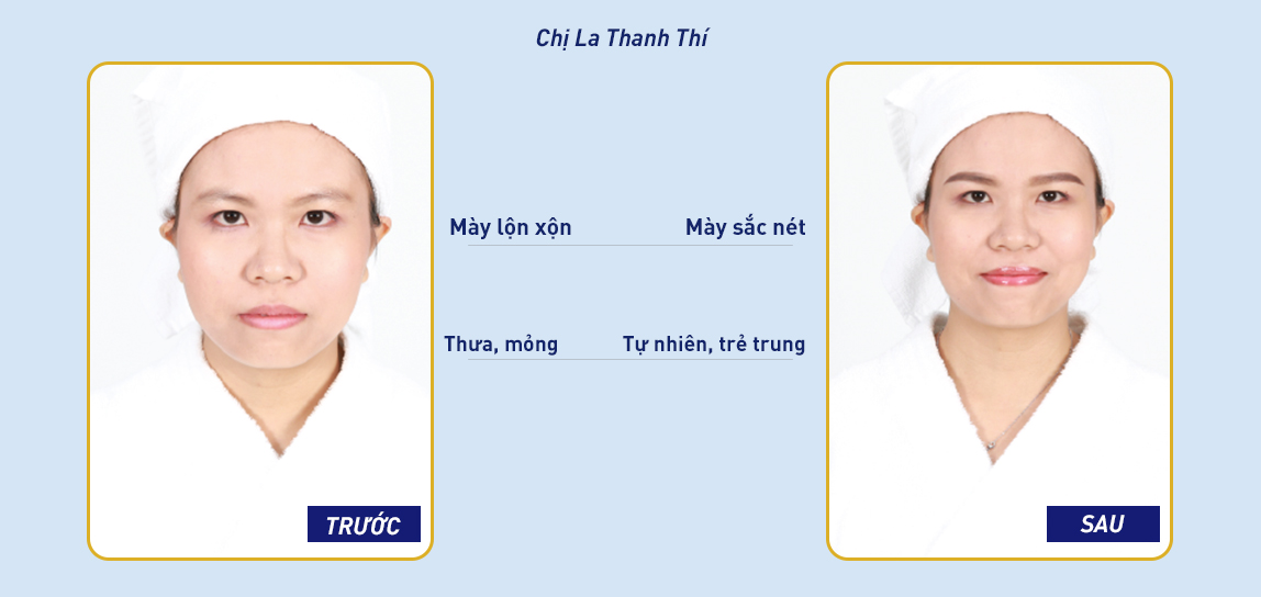 Dịch vụ phun xăm Chạm hạt vi điểm NANO