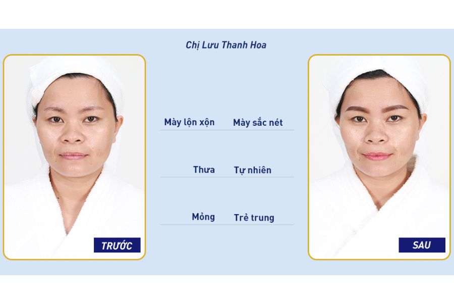 Khách hàng sở hữu dáng mày hài hòa cân đối sau khi trải nghiệm dịch vụ phun xăm tại TMV Ngọc Dung