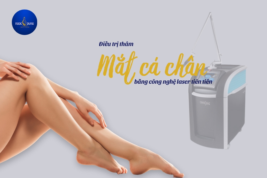 Điều trị mắt cá chân bị thâm bằng công nghệ cao tại TMV Ngọc Dung