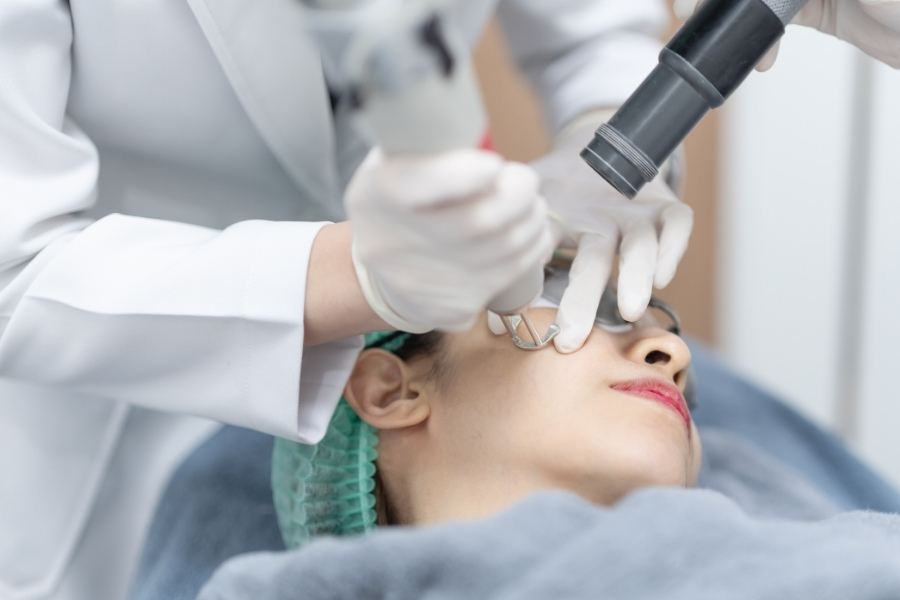 Bắn laser - Cách xóa vết tàn nhang trên mặt hiệu quả nhất