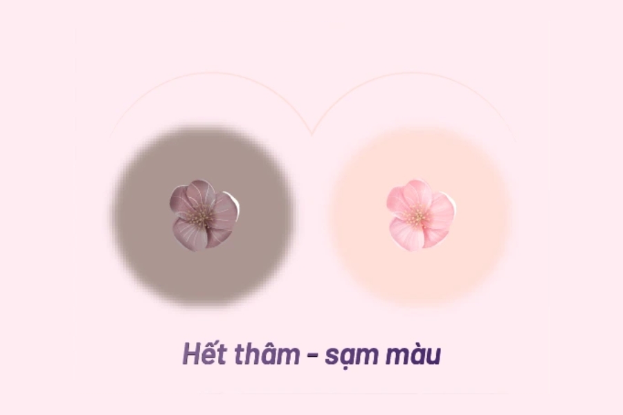 thẩm mỹ làm hồng nhũ hoa