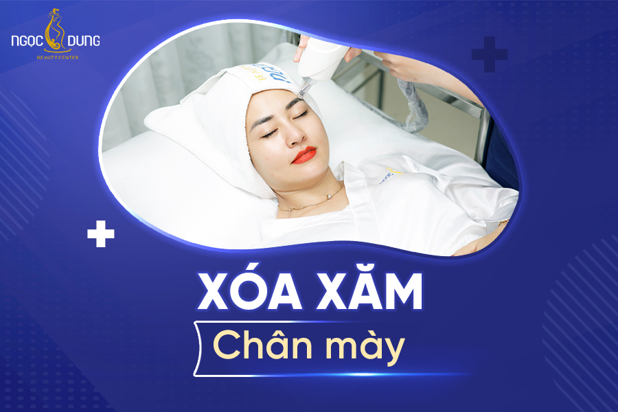 Xóa xăm chân mày