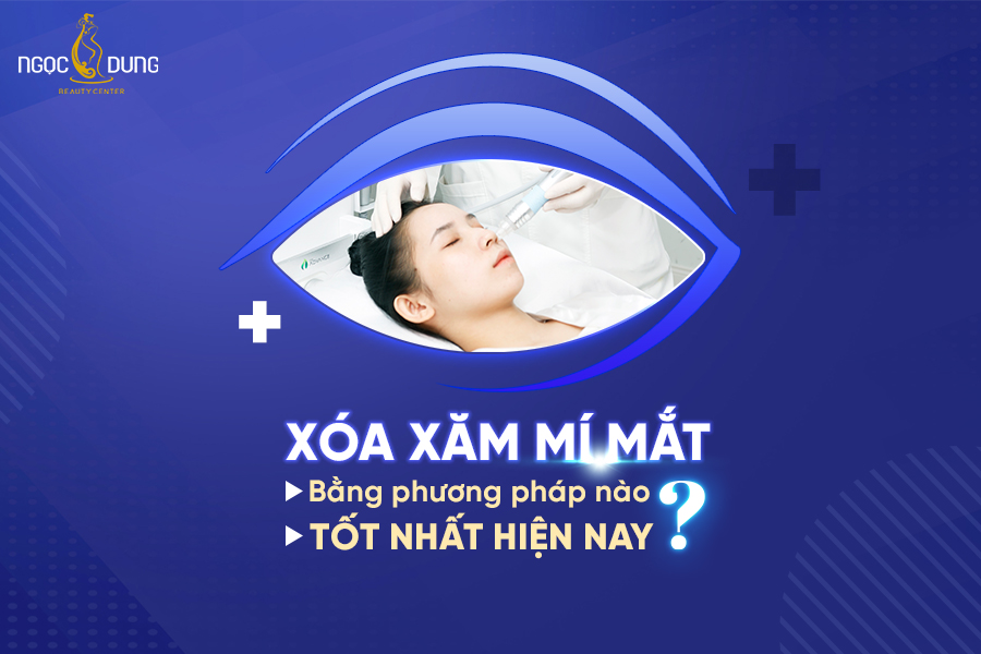 xóa xăm mí mắt