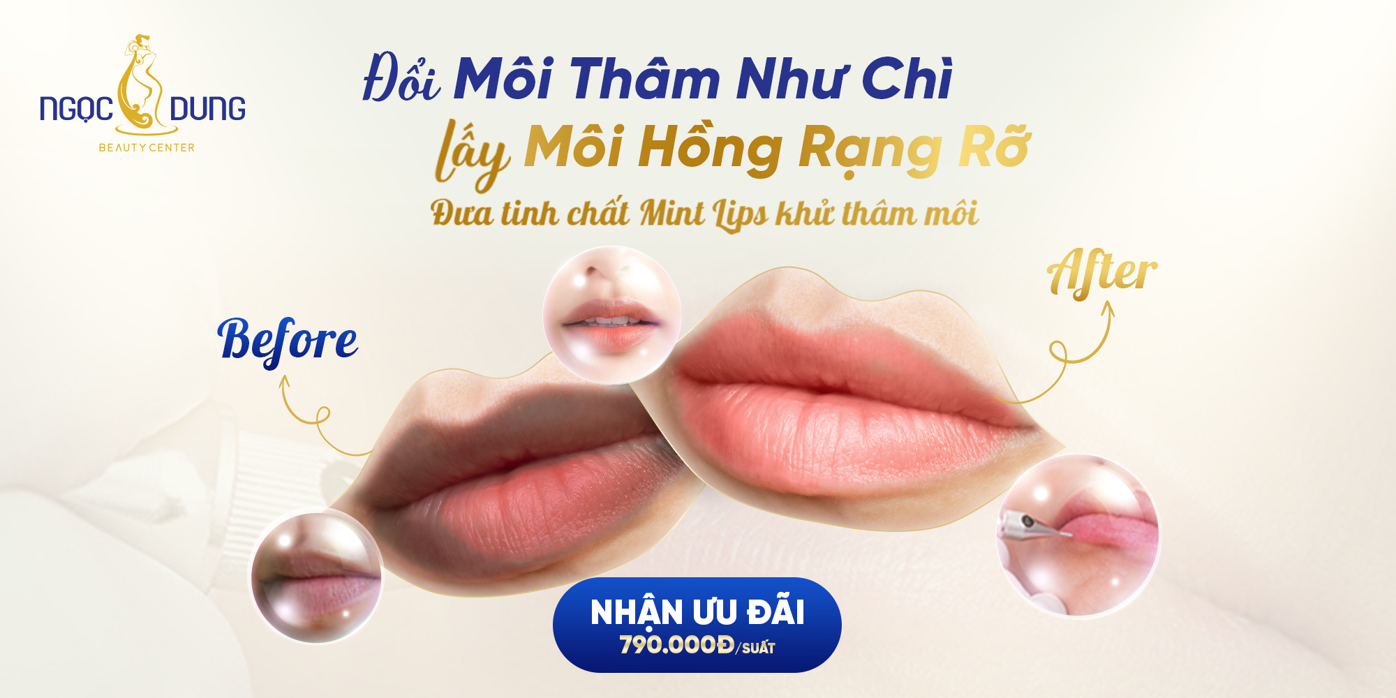 CỨU RỖI ĐÔI MÔI THÂM SẠM VỚI CÔNG NGHỆ ĐƯA TINH CHẤT MINT LIPS
