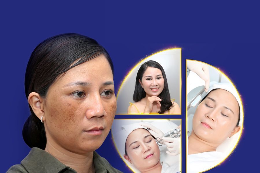 Quá trình thay đổi toàn diện sau khi trải nghiệm công nghệ Helios IV 785