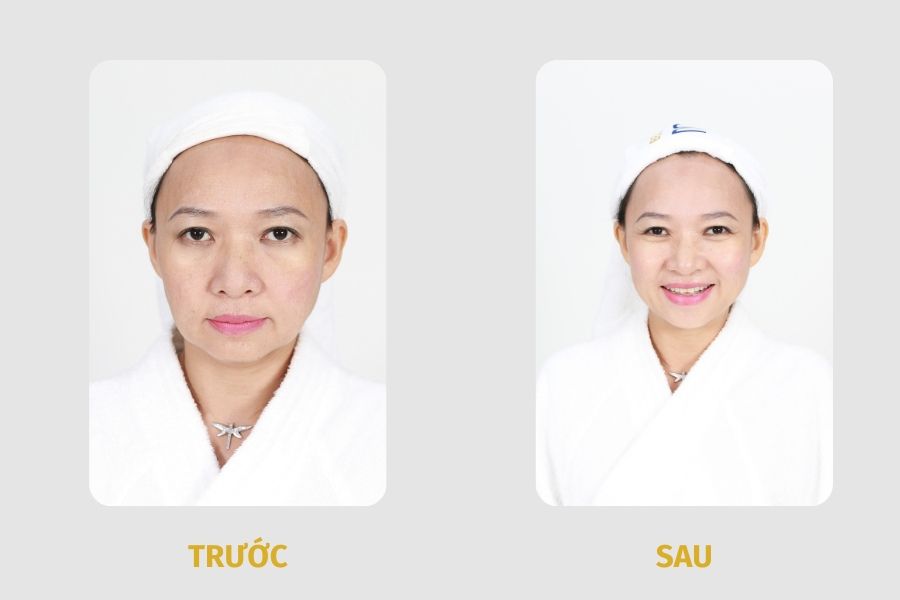 Làn da trẻ khỏe, căng bóng giúp chị Hoàng Anh trở nên tràn đầy năng lượng