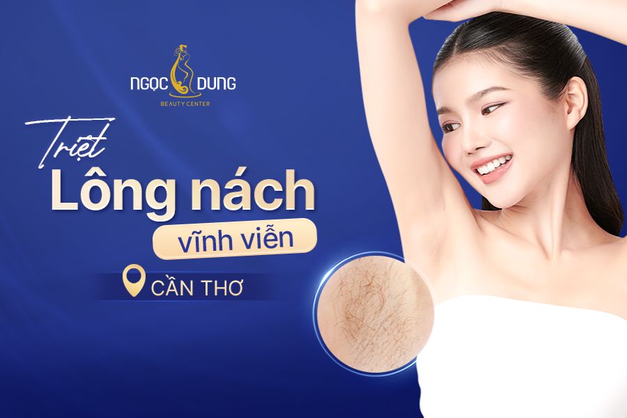 Địa chỉ triệt lông nách vĩnh viễn Cần Thơ – TMV Ngọc Dung
