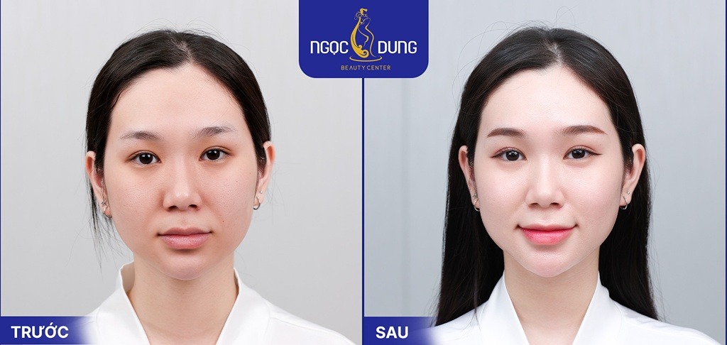 Ủ trắng mặt tinh chất hoa anh đào