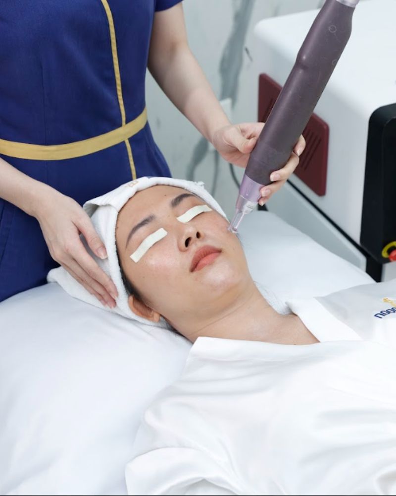 Công nghệ trị tàn nhang an toàn cho mọi loại da