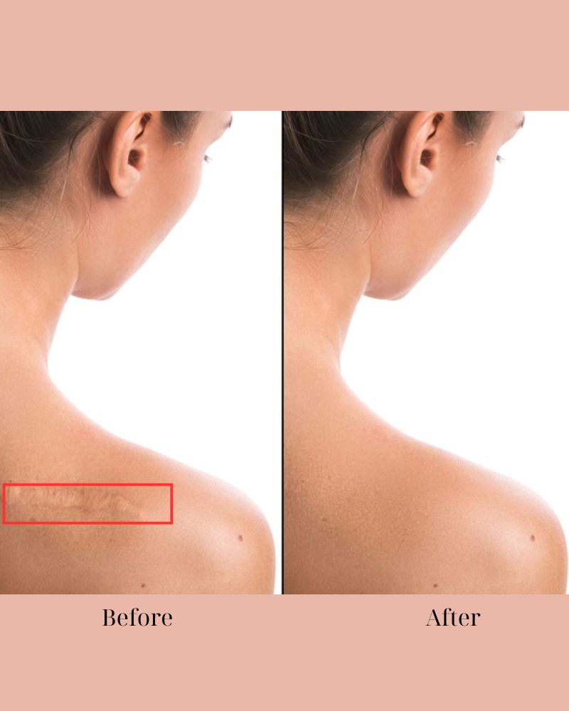 Kết quả vượt trội và lâu dài