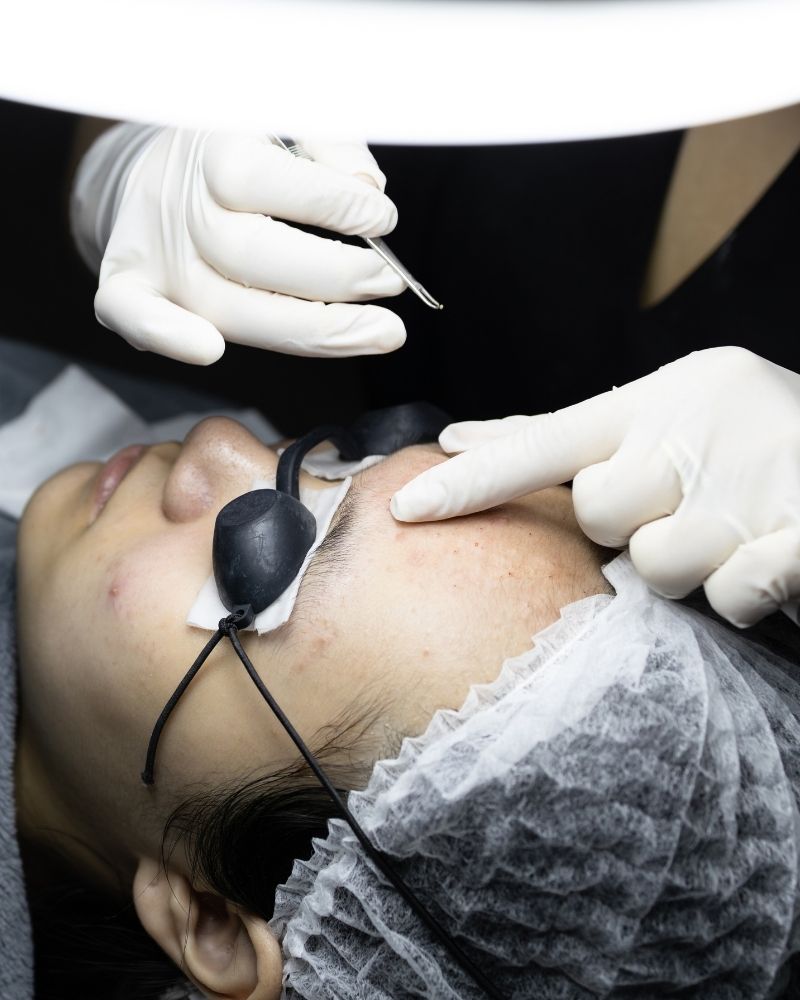 Liệu trình trị mụn có hiệu quả gấp 3 lần phương pháp thông thường