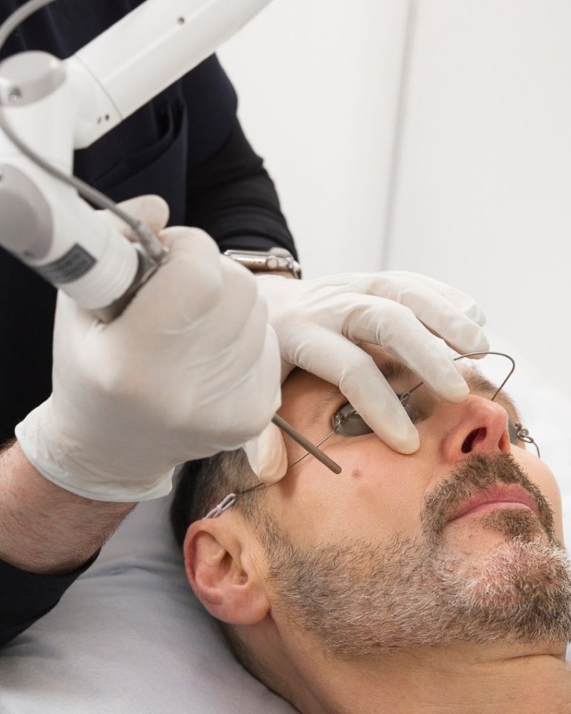 Tẩy nốt ruồi không để lại sẹo