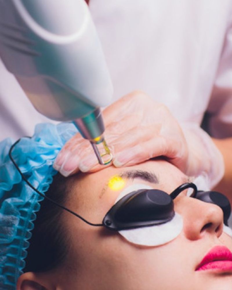 Máy xóa xăm mày được triệt trùng cẩn thận