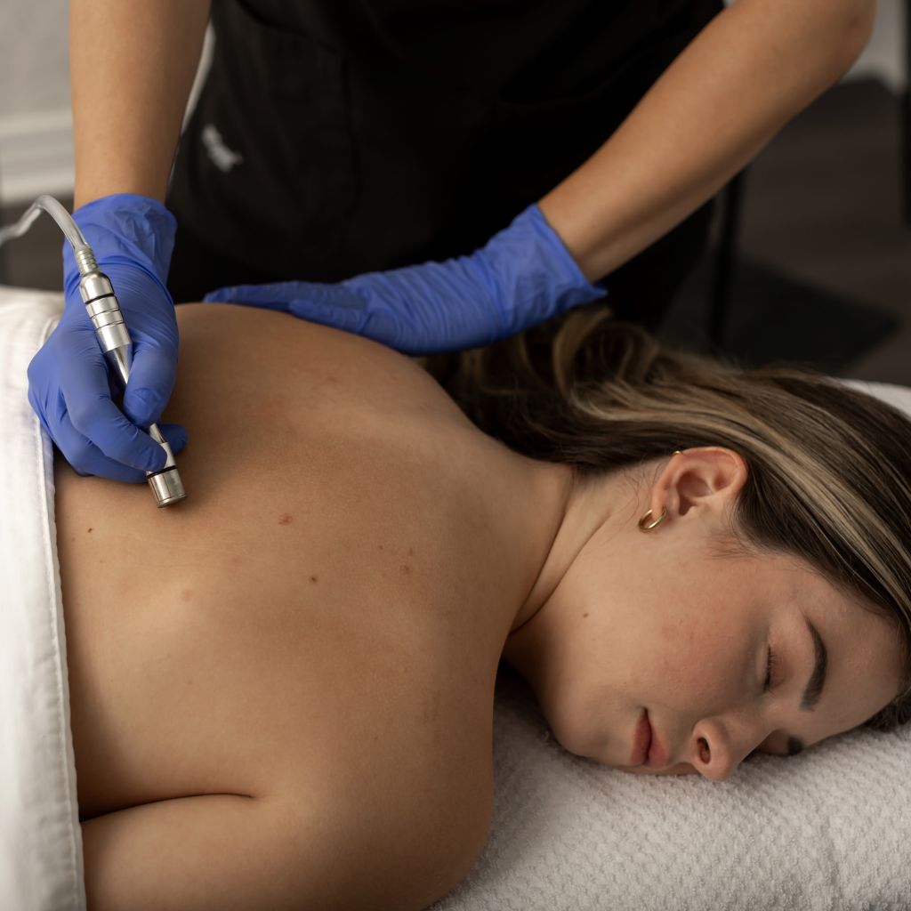 Trị mụn lưng hiệu quả cao tại TMV Ngọc Dung