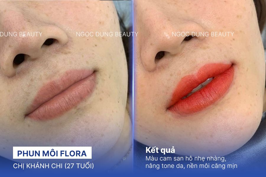 Chị Khánh Chi (27 tuổi) - Phun Môi Flora