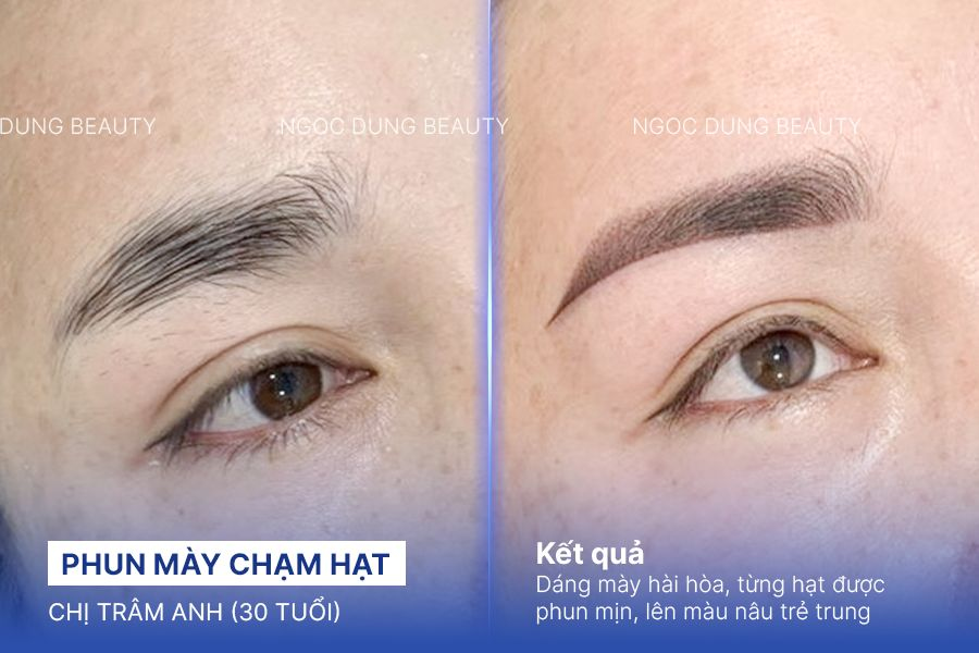 Chị Trâm Anh (30 tuổi) - Phun Mày Chạm Hạt