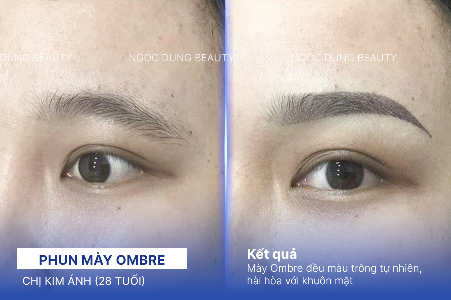 Chị Kim Ánh (28 tuổi) - Phun mày Ombre