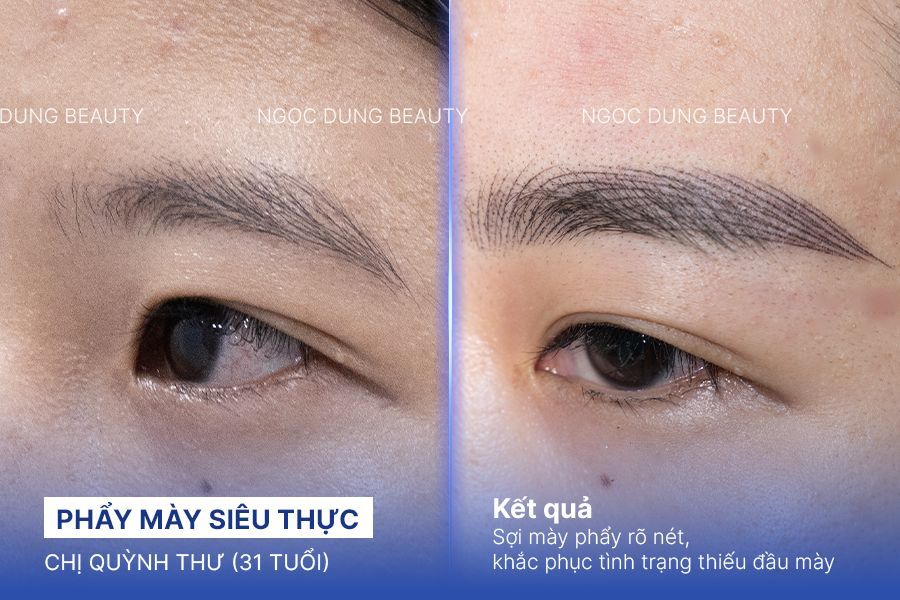 Chị Quỳnh Thư (31 tuổi) - Phẩy Mày Siêu Thực