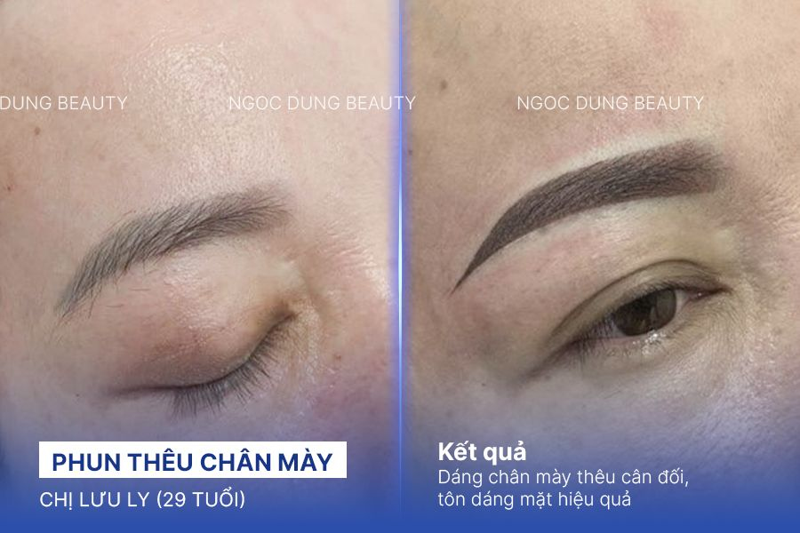 Chị Lưu Ly (29 tuổi) - Phun Thêu Chân Mày