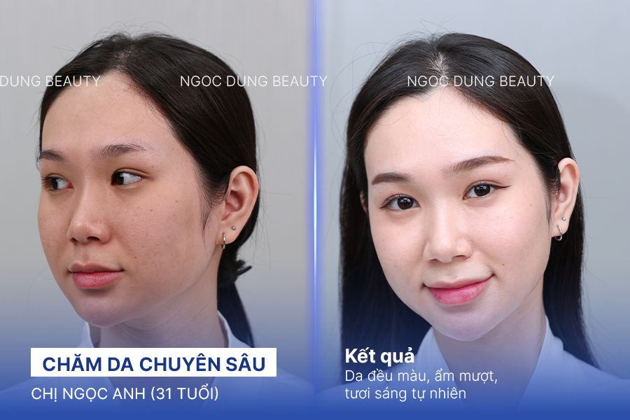 Chăm da chuyên sâu – 3 buổi – Da mịn mượt tươi tắn